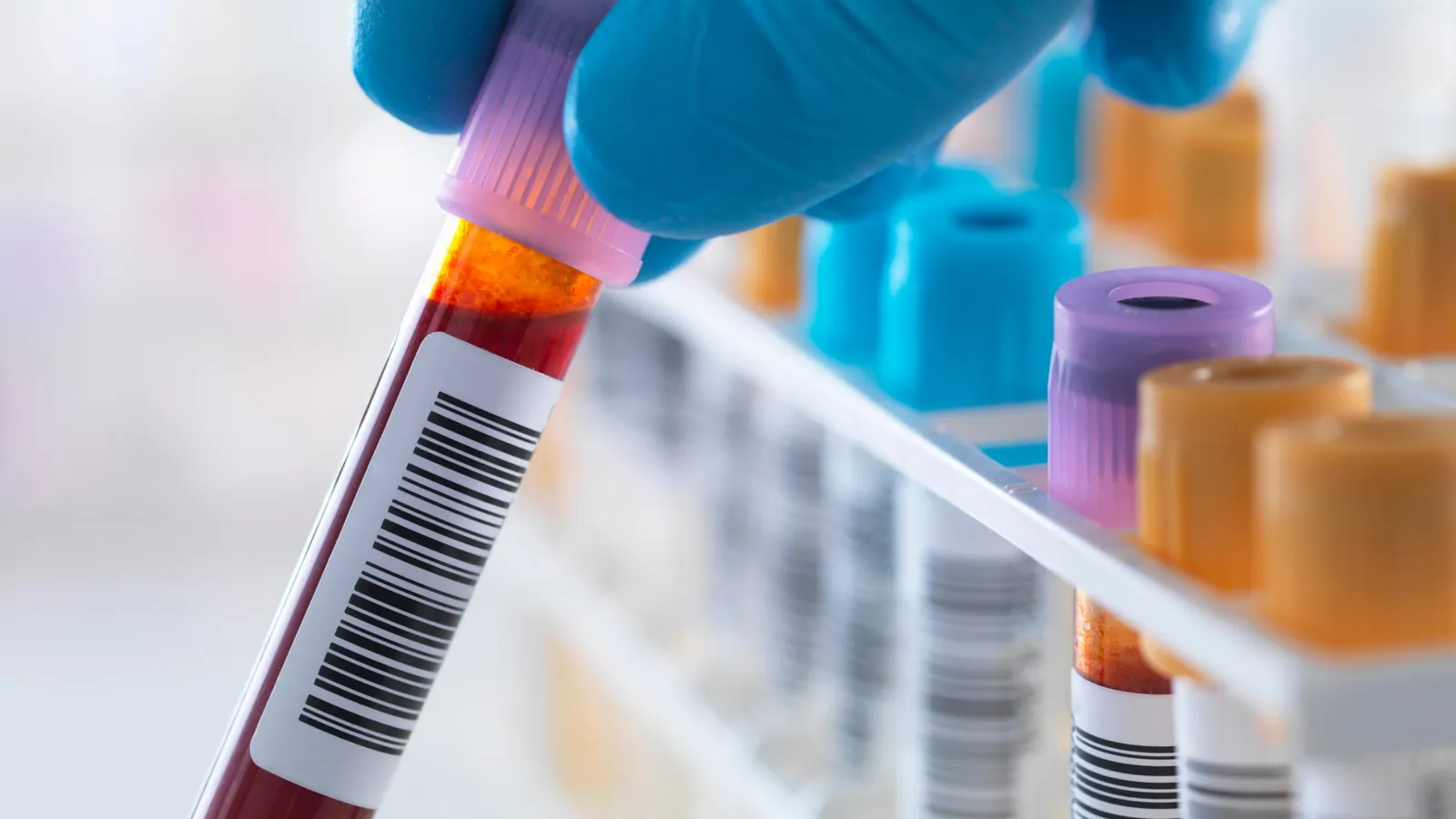 Trouver un expert-comptable pour laboratoire d&rsquo;analyses médicales